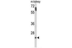 Western blot analysis of SMNDC1 Antibody (N-term) in mouse kidney tissue lysates (35µg/lane).