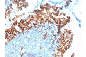 Formalin-fixed, paraffin-embedded human Lymph Node stained with IL3RA/CD123 Mouse Monoclonal Antibody (IL3RA/1531).
