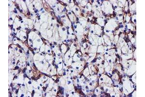 Image no. 10 for anti-Epsin 2 (EPN2) antibody (ABIN1498050)