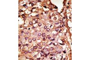 Image no. 1 for anti-Chemokine Binding Protein 2 (CCBP2) (N-Term) antibody (ABIN357385)