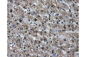 Immunohistochemical staining of paraffin-embedded liver tissue using anti-HSPA1Amouse monoclonal antibody.