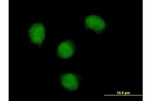 Immunofluorescence of purified MaxPab antibody to NOVA1 on HeLa cell. (NOVA1 anticorps  (AA 1-507))