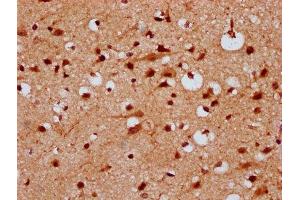IHC image of ABIN7157277 diluted at 1:300 and staining in paraffin-embedded human brain tissue performed on a Leica BondTM system. (KLHL2 anticorps  (AA 1-200))