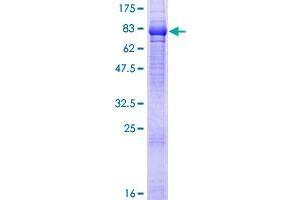 Image no. 1 for TRAF2 and NCK Interacting Kinase (TNIK) (AA 1-538) protein (GST tag) (ABIN1323256)