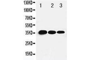 Lane 3: Recombinant Human TBX21 Protein 1. (T-Bet anticorps  (C-Term))