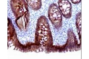 Immunohistochemistry on paraffin embedded sections of small intestine. (E-cadherin anticorps)