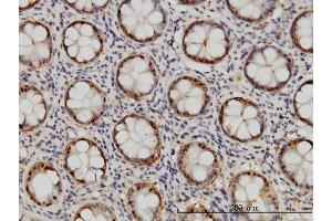 Immunoperoxidase of monoclonal antibody to PSMB6 on formalin-fixed paraffin-embedded human colon.