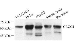 Western blot analysis of CLCC1 (ABIN7073473) at dilution of 1: 500 (CLCC1 anticorps)
