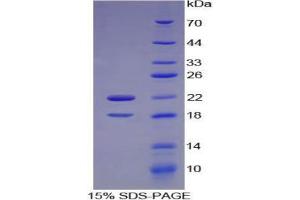 SDS-PAGE analysis of Mouse CSF2Ra Protein. (CSF2RA Protéine)