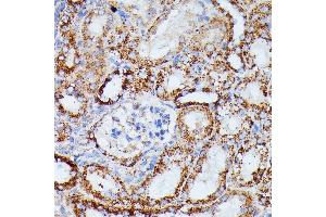 Immunohistochemistry of paraffin-embedded mouse kidney using IDH3A antibody (ABIN7268029) at dilution of 1:100 (40x lens).