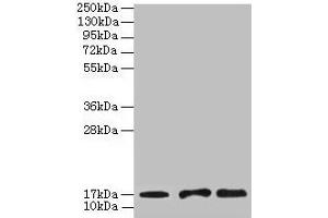 Western blot All lanes: UBE2D1 antibody at 2 μg/mL Lane 1: Mouse thymus tissue Lane 2: NIH/3T3 whole cell lysate Lane 3: Jurkat whole cell lysate Secondary Goat polyclonal to rabbit IgG at 1/10000 dilution Predicted band size: 17 kDa Observed band size: 17 kDa (UBE2D1 anticorps  (AA 1-147))