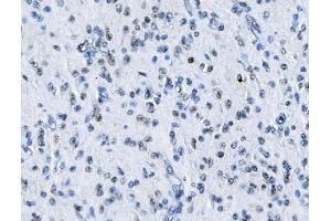 IHC analysis of MTA2 using anti-MTA2 antibody (ABIN7599519). (MTA2 anticorps  (AA 1-668))