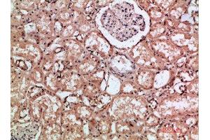 Immunohistochemical analysis of paraffin-embedded human-kidney, antibody was diluted at 1:200