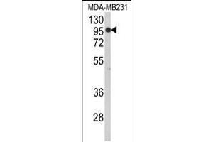 Western blot analysis of BAHD1 Antibody in MDA-MB231 cell line lysates (35ug/lane)