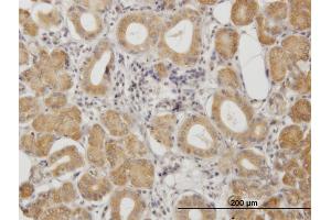 Immunoperoxidase of monoclonal antibody to PRKAR2A on formalin-fixed paraffin-embedded human salivary gland.