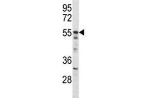 Akt2 antibody western blot analysis in mouse NIH3T3 lysate