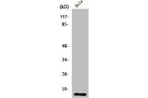 Western Blot analysis of HeLa cells using DOC-1 Polyclonal Antibody (CDK2AP1 anticorps  (Internal Region))