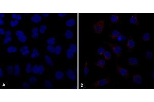 Immunocytochemistry/Immunofluorescence analysis using Mouse Anti-VPS35 Monoclonal Antibody, Clone 10A8 (ABIN6933002).
