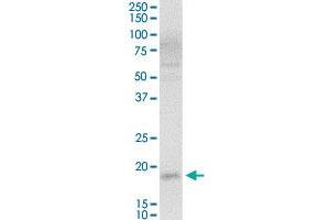 VSTM2L MaxPab rabbit polyclonal antibody. (VSTM2L anticorps  (AA 1-204))