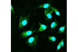 IF analysis of CARD9 using anti-CARD9 antibody (ABIN7599386). (CARD9 anticorps  (AA 1-429))