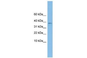 KLHDC9 antibody used at 1 ug/ml to detect target protein. (KLHDC9 anticorps  (Middle Region))