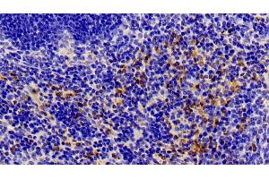 Detection of ANXA1 in Mouse Spleen Tissue using Polyclonal Antibody to Annexin A1 (ANXA1)