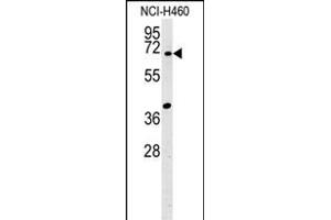 SYN3 Antibody (Center) (ABIN651941 and ABIN2840467) western blot analysis in NCI- cell line lysates (15 μg/lane). (Synapsin III anticorps  (AA 363-388))