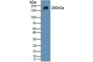 Detection of MAP2 in Rat Brain Tissue using Polyclonal Antibody to Microtubule Associated Protein 2 (MAP2)