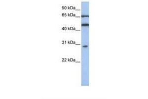 Image no. 1 for anti-Interferon-Induced Protein with Tetratricopeptide Repeats 5 (IFIT5) (AA 110-159) antibody (ABIN6739018) (IFIT5 anticorps  (AA 110-159))