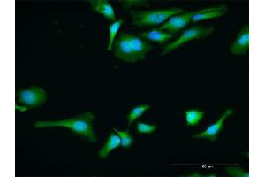 Immunofluorescence of purified MaxPab antibody to PABPC1 on HeLa cell.