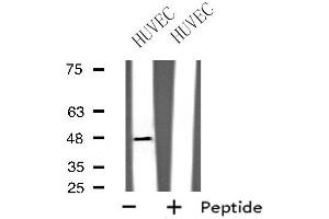 Western blot analysis of extracts from HUVEC cells using GPRC5B antibody. (GPRC5B anticorps  (Internal Region))