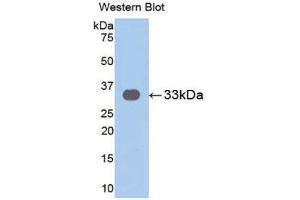 Western Blotting (WB) image for anti-Interleukin 31 Receptor A (IL31RA) (AA 205-456) antibody (ABIN1859419) (IL31RA anticorps  (AA 205-456))
