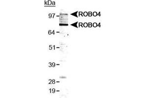 Western blot analysis of ROBO4 in HUVEC cell lysate with ROBO4 polyclonal antibody . (ROBO4 anticorps  (AA 200-300))