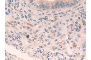 Detection of LGMN in Mouse Uterus Tissue using Polyclonal Antibody to Legumain (LGMN)