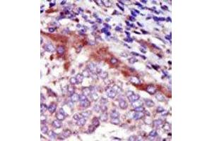 Image no. 2 for anti-Hormonally Up-Regulated Neu-Associated Kinase (HUNK) (C-Term) antibody (ABIN360358) (HUNK anticorps  (C-Term))