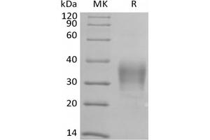 Western Blotting (WB) image for CD79b Molecule, Immunoglobulin-Associated beta (CD79B) protein (Biotin,His-Avi Tag) (ABIN7319845)