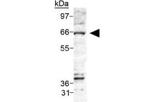 Western blot analysis of CERK on Ceramide Kinase in A-549 cell lysate using CERK polyclonal antibody . (CERK anticorps  (AA 50-150))