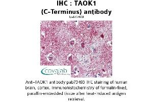 Image no. 1 for anti-TAO Kinase 1 (TAOK1) (C-Term) antibody (ABIN1739898) (TAO Kinase 1 (TAOK1) (C-Term) anticorps)