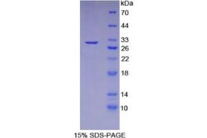 SDS-PAGE analysis of Human CAD Protein. (DFFB Protéine)