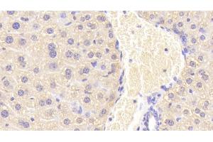Detection of CORT in Mouse Liver Tissue using Polyclonal Antibody to Carnitine-O-Octanoyltransferase (CORT)