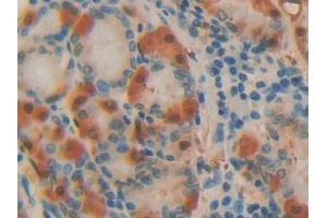 DAB staining on IHC-P; Samples: Human Stomach Tissue (ADA anticorps  (AA 11-280))