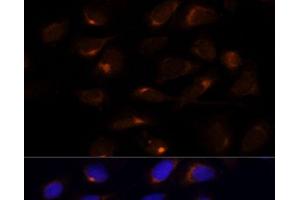 Immunofluorescence analysis of U-2 OS cells using SCD Polyclonal Antibody at dilution of 1:100 (40x lens). (SCD anticorps)