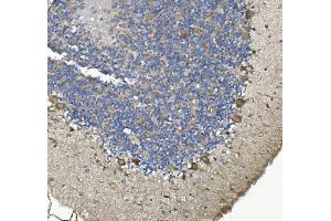 IHC analysis of non-muscle Myosin IIB/MYH10 using anti-non-muscle Myosin IIB/MYH10 antibody (ABIN7603186). (MYH10 anticorps  (N-Term))