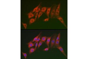 Immunofluorescence analysis of NIH/3T3 cells using MTMR14 Rabbit pAb (ABIN6129695, ABIN6144154, ABIN6144155 and ABIN6223372) at dilution of 1:100 (40x lens). (MTMR14 anticorps  (AA 1-280))
