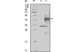 Western blot analysis using EphA4 mouse mAb against truncated Trx-EphA4 recombinant protein (1) and truncated GST-EphA4(aa777-986) recombinant protein (2). (EPH Receptor A4 anticorps  (AA 777-986))