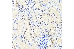 Immunohistochemistry of paraffin-embedded mouse kidney using RUNX1 antibody (ABIN6291786) at dilution of 1:100 (40x lens). (RUNX1 anticorps)