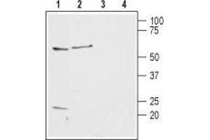 Western blot analysis of rat basophilic leukemia cells (RBL) (lanes 1 and 3) and rat brain lysates (lanes 2 and 4): - 1,2. (HRH2 anticorps  (2nd Extracellular Loop))