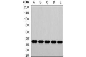 Western blot analysis of PSMC4 expression in HepG2 (A), A549 (B), Hela (C), Jurkat (D), mouse liver (E) whole cell lysates. (PSMC4 anticorps)