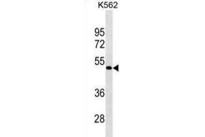 Western Blotting (WB) image for anti-G Protein-Coupled Receptor 39 (GPR39) antibody (ABIN3000707)