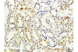 Formalin-fixed and paraffin embedded rat kidney labeled with Anti- NCX2/SLC8A2 Polyclonal Antibody, Unconjugated (ABIN676478) at 1:200 followed by conjugation to the secondary antibody and DAB staining (SLC8A2 anticorps  (AA 601-700))